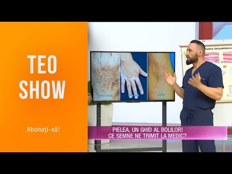 Teo Show(25.03)-Pielea, un ghid al bolilor! Ce semne ne trimit la medic? Cum pastrezi pielea tanara?