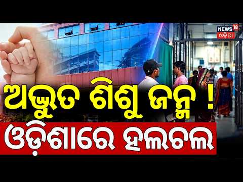 Two Headed Baby Born In Berhampur MKCG College | ଅଦ୍ଭୁତ ଶିଶୁ ଜନ୍ମ ! Rare Baby Born | Odia News