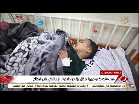 معاناة شديدة يواجهها أطفال غـ ـزة جراء العدوان الإسر ائيلي على القطاع 