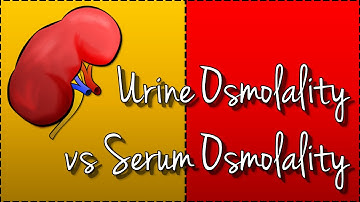 Urine Osmolality vs Serum Osmolality (Hyponatraemia)