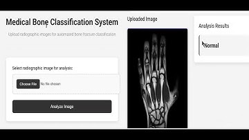 Bone Tumour Detection Using Image Processing and AI | Early Diagnosis System #pythonprojects #video