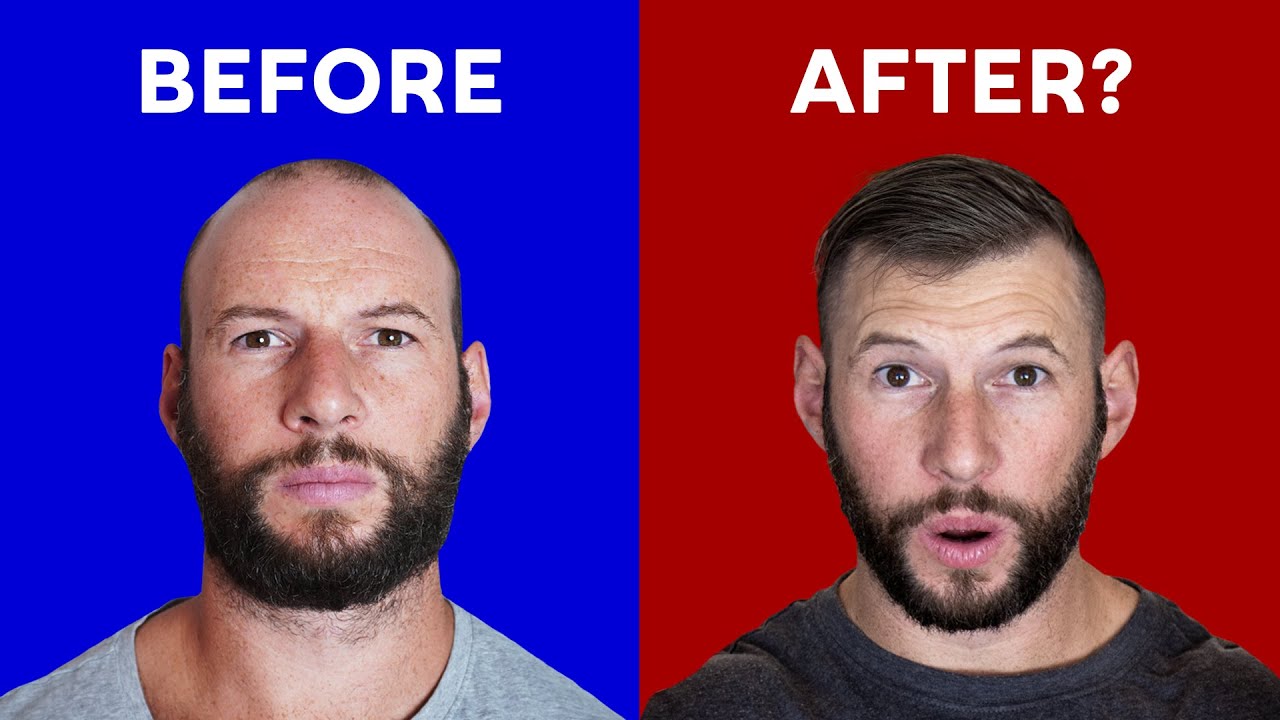 CurrentBody Hair Regrowth: Before & After Surprise?!