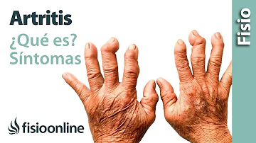 ¿Cómo se siente el dolor de la artritis?
