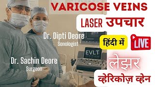 Varicose Vein Treatment| Varicose Vein Laser | EVLT | EVLS | लेजर सर्जरी | Varicose Vein Surgery