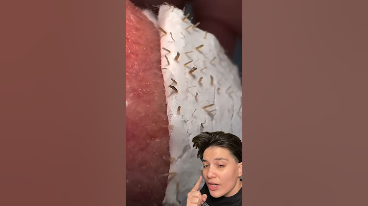 Burun temizleme macununu deniyorum! Siyah nokta maskesi #tiktokviral #shorts