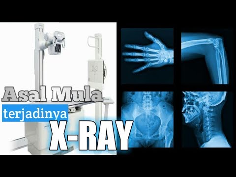 Proses Terjadinya x ray ( Asal Mula X-ray )