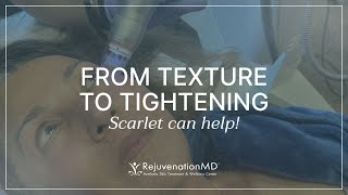 The Skin Tightening Treatment You Didn’t Know You Could Have