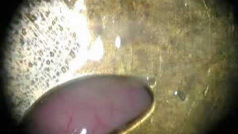 Micro-dissection of Rat Brain for RNA or Protein Extraction from Specific Brain Region