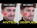 Como eliminar facilmente las OJERAS OSCURAS y Las BOLSAS