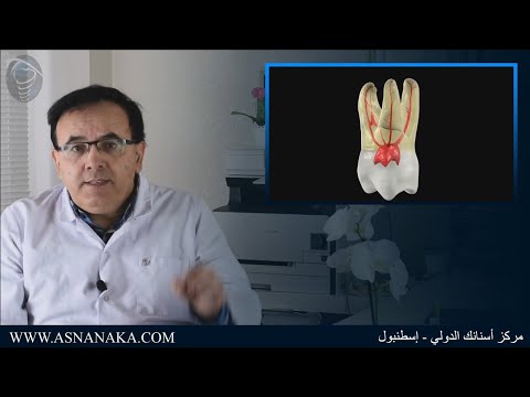 فيديو: حتى لا تؤذي الأسنان