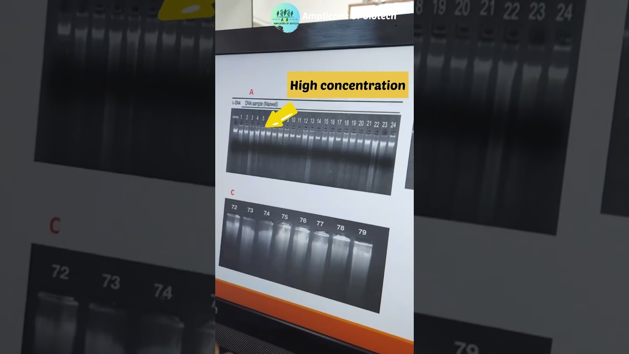 DNA Gel electrophoresis interpretation 