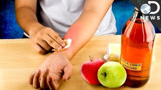 Is Apple Cider Vinegar A Miracle Cure? Is Apple Cider Vinegar A Miracle Cure?