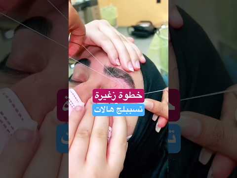 خطوة زغيرة تسببلج هالات