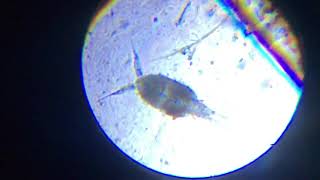 Saltwater Copepod Under Microscope
