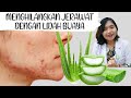 Jerawat Hilang, Kulit Sehat dengan Lidah Buaya: Rahasia Kecantikan Alami