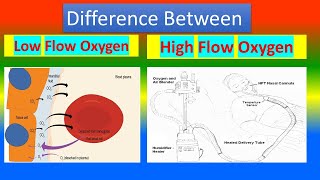 Difference Between Low Flow Oxygen and High Flow Oxygen