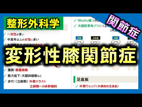 【関節症③】変形性膝関節症【理学療法士・作業療法士】