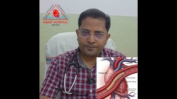 Dr Vinit shares his experience about CTO Angioplasty He has performed 700+ CTO PTCA in last 7 years.