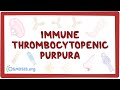 Immune thrombocytopenic purpura  an osmosis preview