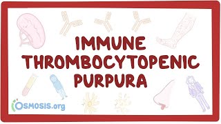 Immune thrombocytopenic purpura - an Osmosis Preview