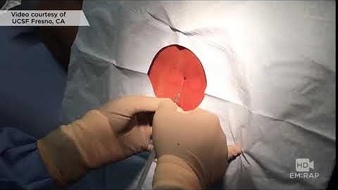 Lumbar puncture & insertion of lumbar drain tube