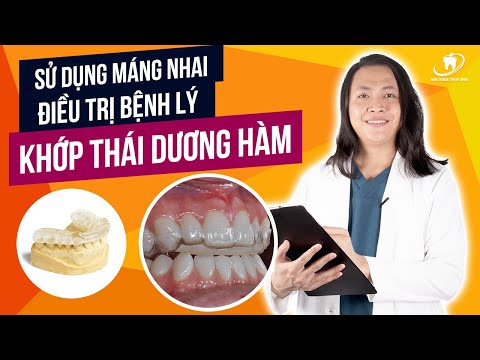 hướng dẫn vệ sinh răng miệng khi mang mắc cài tại Kemtrinam.vn