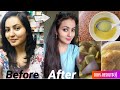 30 Days Extreme Hair Growth Challenge : Use This Hair Growth Tonic for Triple Hair Growth & Density