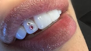 How to apply tooth gems