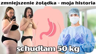 OPERACJA BARIATRYCZNA - planowałam zmniejszyć żołądek, by schudnąć ze 130 kg by Paulina Gładysz 70,874 views 3 months ago 30 minutes