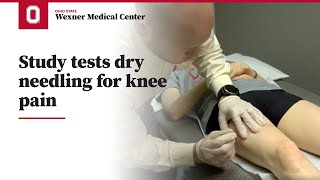 Study Aims to get to the Point of Dry Needling for Knee Pain