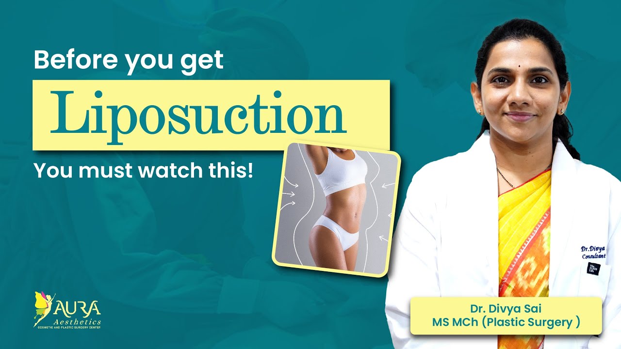 Is Liposuction safe?Watch till end to know the complications you should be aware of!!