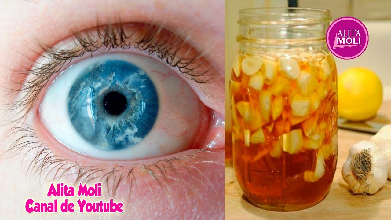 Increíble! recupera tu visión en un 80% con este remedio natural - YouTube