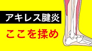 アキレス腱炎が改善した女性と治し方について解説