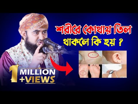 ভিডিও: জন্ম চিহ্ন এবং তিল কি একই জিনিস?