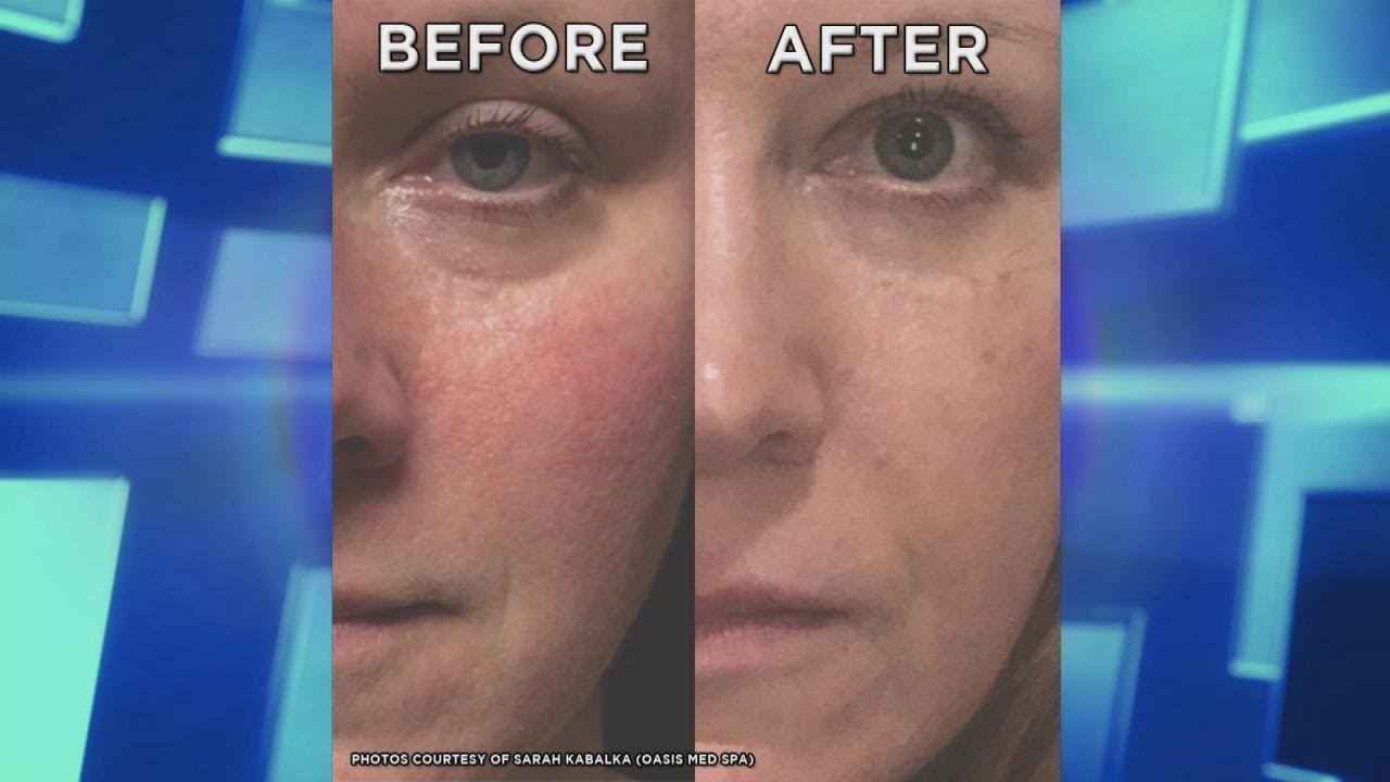 physical education Couples Happier in Open Relationships? Ask The Doctors: Skin Cancer Where the Sun Doesn’t Shine? …