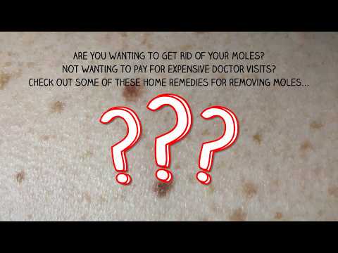 वीडियो: उनकी गर्मियों की झोपड़ी में मोल्स से कैसे निपटें