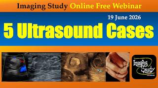 5 Ultrasound Cases || Imaging Study || 19 June 2026 || Online Webinar