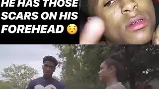 Celebrity NBA YOUNGBOY EXPLAINS WY HE HAS THOSE SCARS ON HIS FOREHEAD😯😯😯😯 Profile