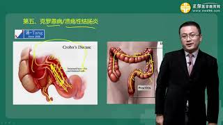 0302第02讲 肠结核、克罗恩病、溃疡性结肠炎