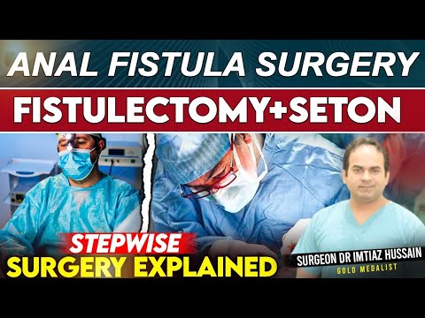 Can Oronasal Fistulas Be Repaired? – BDQQZJ