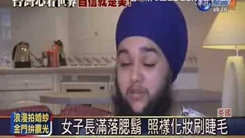 罕见女生长胡须 - 天天要闻