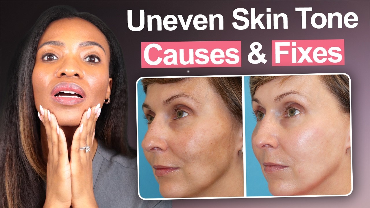 Как исправить неровный тон кожи (дерматолог объясняет истинную причину)