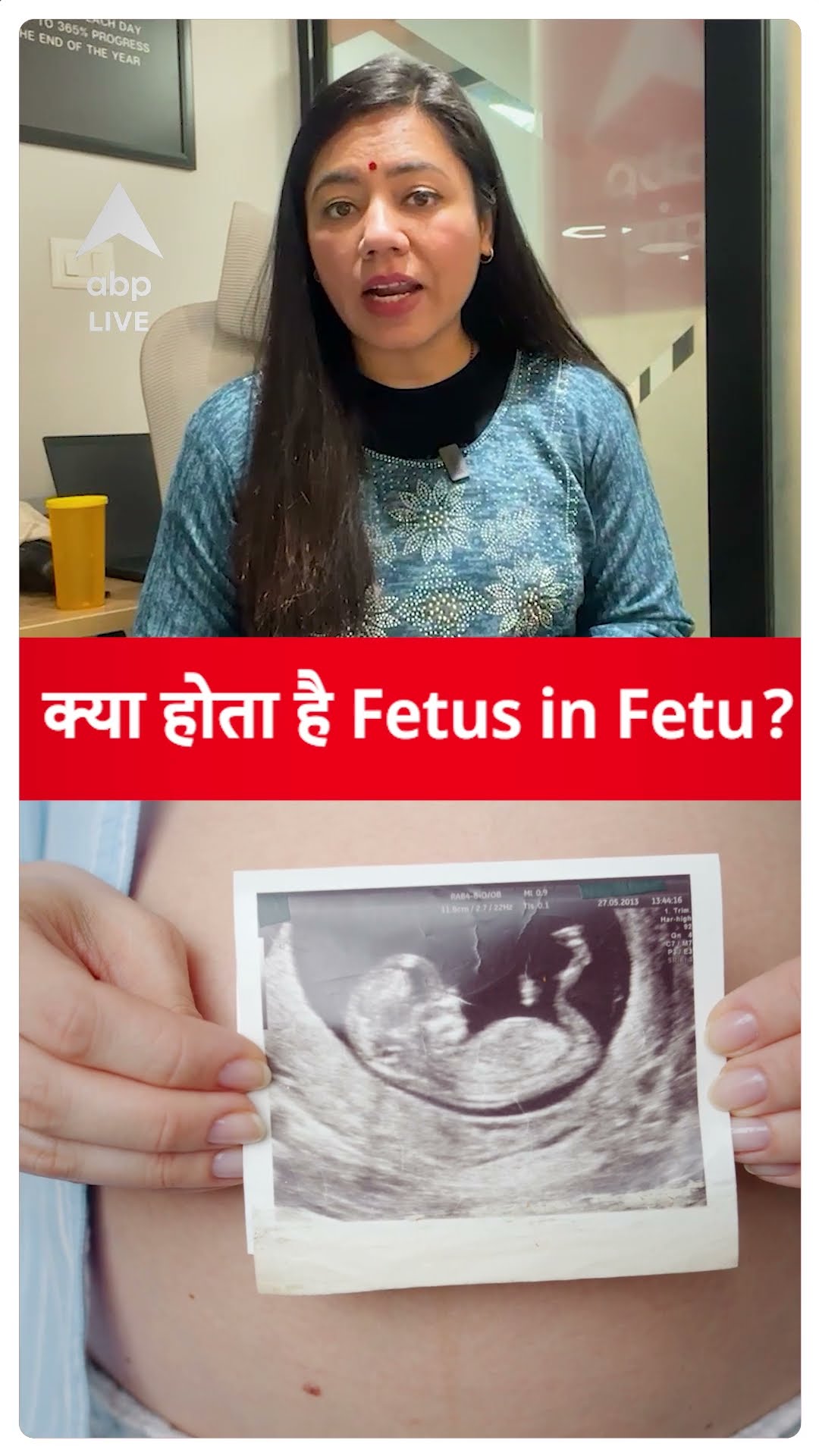 EXPLAINED: महाराष्ट्र में आया Fetus in Fetu का RARE CASE! | ABPLIVE