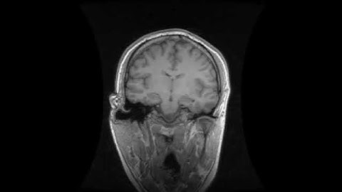 Cutting Edge Biomedical Imaging | MRI Scan of a Person