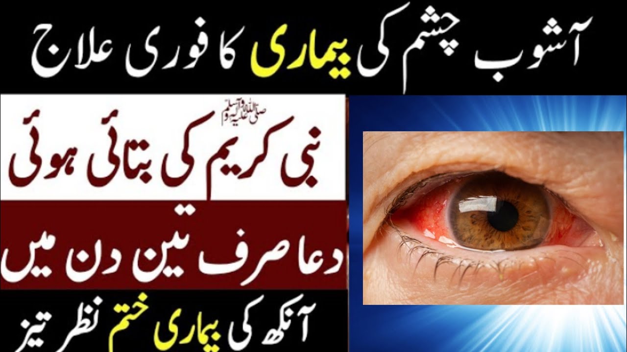 Ashob e chashm ka ilaj Eye infection treatment Ankoon main dard ki