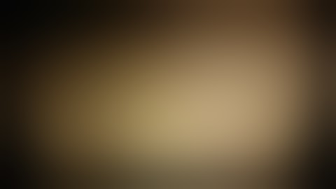 Retroperitoneoscopy anatomy ports Pyelolithotomy