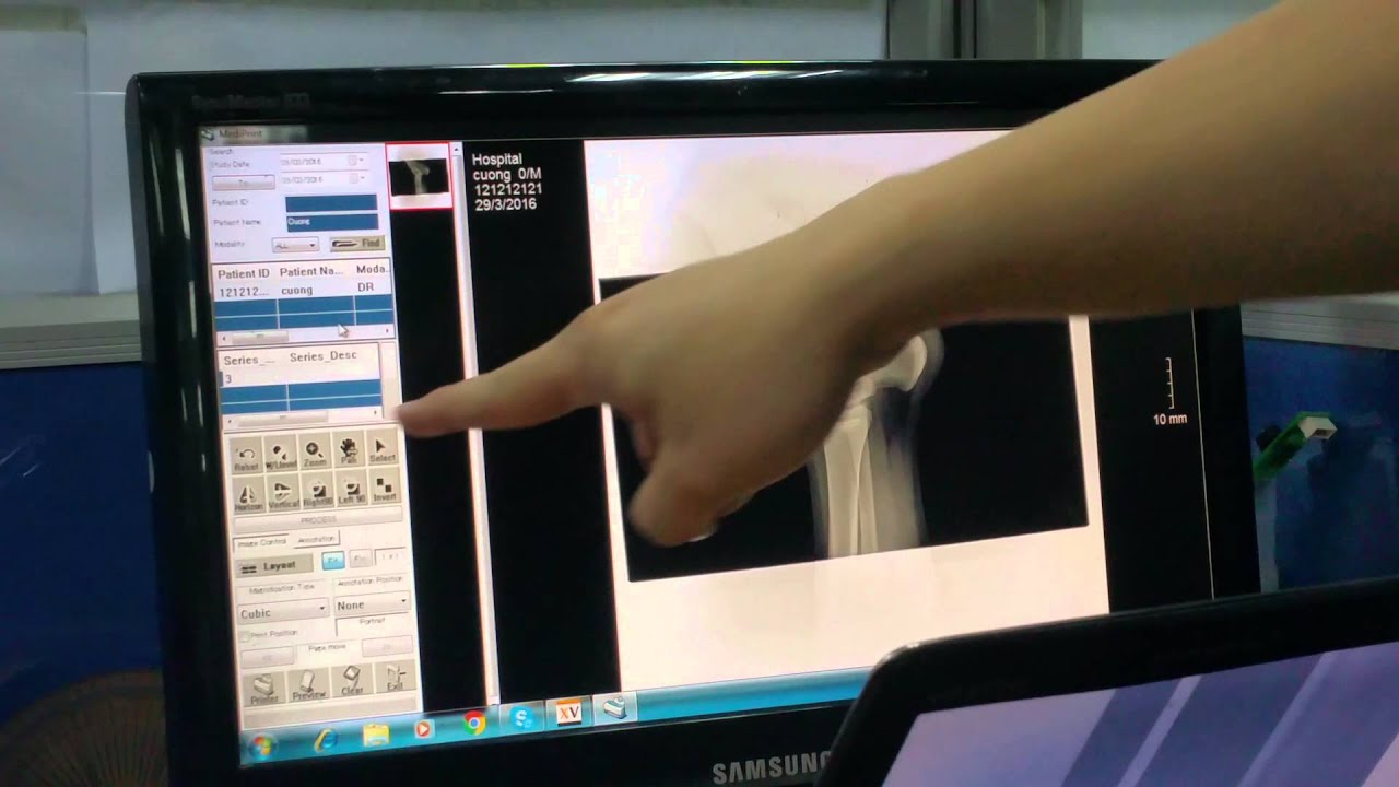 How to use Xview 3.0 to print image YouTube