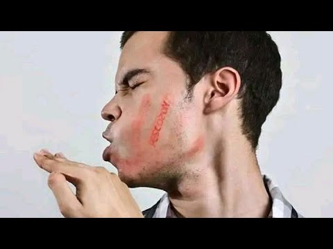 تفسير رؤيه ضرب كف علي الوجه في المنام