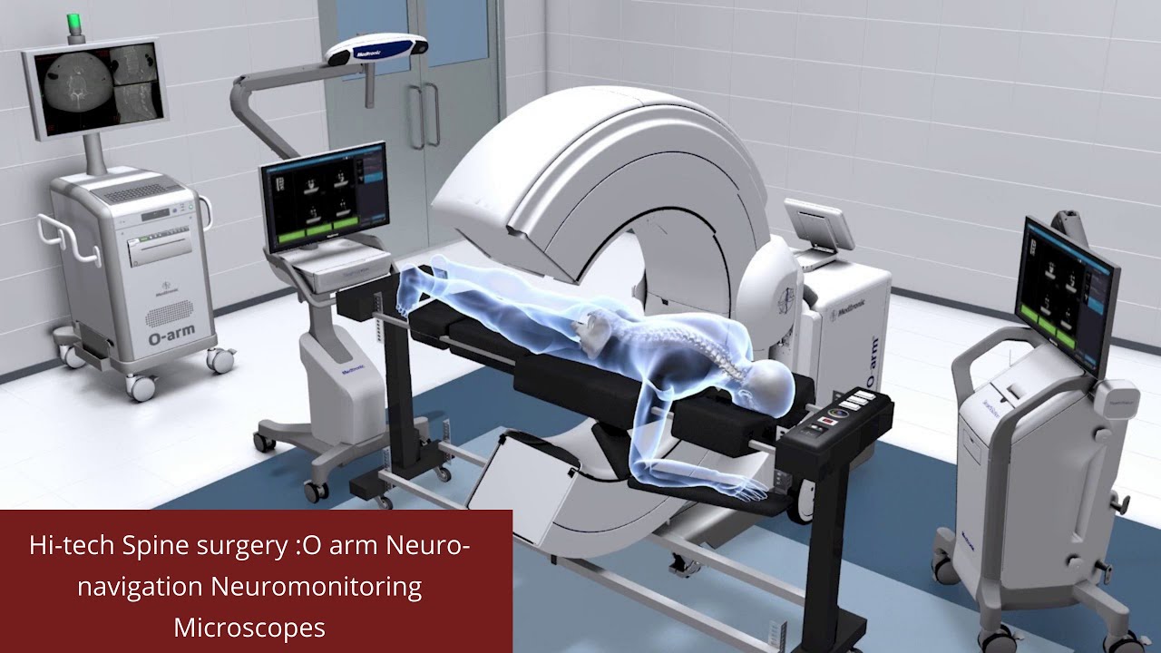 Hi-tech Spine surgery: O arm Neuro-navigation Neuromonitoring Microscopes | Sancheti Hospital