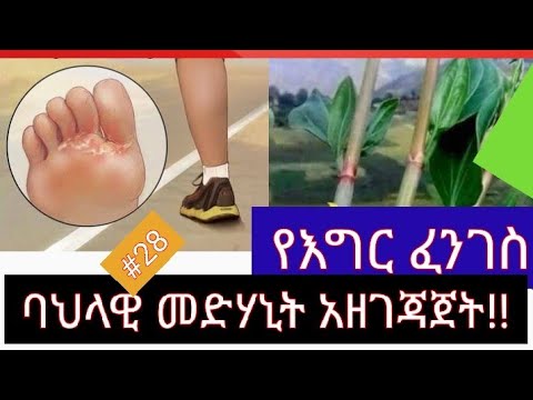 ቪዲዮ: የእግር ጣት ፈንገስን እንዴት ማስወገድ እንደሚቻል - 11 ደረጃዎች (ከስዕሎች ጋር)